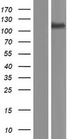 Western blot validation of overexpression lysate (Cat# LY405288) using anti-DDK antibody (Cat# TA50011-100). Left: Cell lysates from un-transfected HEK293T cells; Right: Cell lysates from HEK293T cells transfected with RC214717 using transfection reagent MegaTran 2.0 (Cat# TT210002).