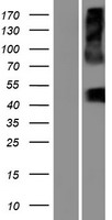 Western blot validation of overexpression lysate (Cat# LY404464) using anti-DDK antibody (Cat# TA50011-100). Left: Cell lysates from un-transfected HEK293T cells; Right: Cell lysates from HEK293T cells transfected with RC221552 using transfection reagent MegaTran 2.0 (Cat# TT210002).