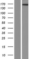 Western blot validation of overexpression lysate (Cat# LY404082) using anti-DDK antibody (Cat# TA50011-100). Left: Cell lysates from un-transfected HEK293T cells; Right: Cell lysates from HEK293T cells transfected with RC218226 using transfection reagent MegaTran 2.0 (Cat# TT210002).