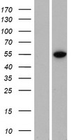Western blot validation of overexpression lysate (Cat# LY407071) using anti-DDK antibody (Cat# TA50011-100). Left: Cell lysates from un-transfected HEK293T cells; Right: Cell lysates from HEK293T cells transfected with RC217357 using transfection reagent MegaTran 2.0 (Cat# TT210002).