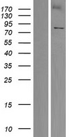 Western blot validation of overexpression lysate (Cat# LY409264) using anti-DDK antibody (Cat# TA50011-100). Left: Cell lysates from un-transfected HEK293T cells; Right: Cell lysates from HEK293T cells transfected with RC217388 using transfection reagent MegaTran 2.0 (Cat# TT210002).