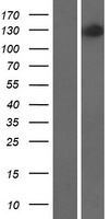 Western blot validation of overexpression lysate (Cat# LY421528) using anti-DDK antibody (Cat# TA50011-100). Left: Cell lysates from un-transfected HEK293T cells; Right: Cell lysates from HEK293T cells transfected with RC217433 using transfection reagent MegaTran 2.0 (Cat# TT210002).