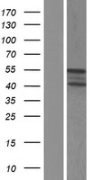 Western blot validation of overexpression lysate (Cat# LY406986) using anti-DDK antibody (Cat# TA50011-100). Left: Cell lysates from un-transfected HEK293T cells; Right: Cell lysates from HEK293T cells transfected with RC217338 using transfection reagent MegaTran 2.0 (Cat# TT210002).