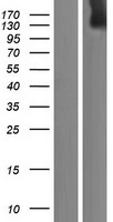 Western blot validation of overexpression lysate (Cat# LY410913) using anti-DDK antibody (Cat# TA50011-100). Left: Cell lysates from un-transfected HEK293T cells; Right: Cell lysates from HEK293T cells transfected with RC217481 using transfection reagent MegaTran 2.0 (Cat# TT210002).