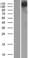 Western blot validation of overexpression lysate (Cat# LY414520) using anti-DDK antibody (Cat# TA50011-100). Left: Cell lysates from un-transfected HEK293T cells; Right: Cell lysates from HEK293T cells transfected with RC217516 using transfection reagent MegaTran 2.0 (Cat# TT210002).