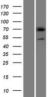 Western blot validation of overexpression lysate (Cat# LY420543) using anti-DDK antibody (Cat# TA50011-100). Left: Cell lysates from un-transfected HEK293T cells; Right: Cell lysates from HEK293T cells transfected with RC217489 using transfection reagent MegaTran 2.0 (Cat# TT210002).