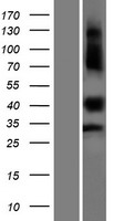 Western blot validation of overexpression lysate (Cat# LY407614) using anti-DDK antibody (Cat# TA50011-100). Left: Cell lysates from un-transfected HEK293T cells; Right: Cell lysates from HEK293T cells transfected with RC218144 using transfection reagent MegaTran 2.0 (Cat# TT210002).