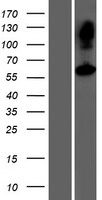 Western blot validation of overexpression lysate (Cat# LY420721) using anti-DDK antibody (Cat# TA50011-100). Left: Cell lysates from un-transfected HEK293T cells; Right: Cell lysates from HEK293T cells transfected with RC218090 using transfection reagent MegaTran 2.0 (Cat# TT210002).