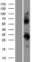 Western blot validation of overexpression lysate (Cat# LY405475) using anti-DDK antibody (Cat# TA50011-100). Left: Cell lysates from un-transfected HEK293T cells; Right: Cell lysates from HEK293T cells transfected with RC218067 using transfection reagent MegaTran 2.0 (Cat# TT210002).
