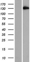 Western blot validation of overexpression lysate (Cat# LY414454) using anti-DDK antibody (Cat# TA50011-100). Left: Cell lysates from un-transfected HEK293T cells; Right: Cell lysates from HEK293T cells transfected with RC218028 using transfection reagent MegaTran 2.0 (Cat# TT210002).