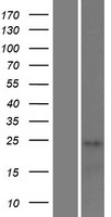 Western blot validation of overexpression lysate (Cat# LY412829) using anti-DDK antibody (Cat# TA50011-100). Left: Cell lysates from un-transfected HEK293T cells; Right: Cell lysates from HEK293T cells transfected with RC218154 using transfection reagent MegaTran 2.0 (Cat# TT210002).