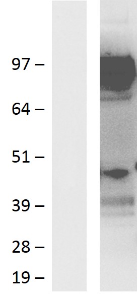 Western blot validation of overexpression lysate (Cat# LY412929) using anti-DDK antibody (Cat# TA50011-100). Left: Cell lysates from un-transfected HEK293T cells; Right: Cell lysates from HEK293T cells transfected with RC217805 using transfection reagent MegaTran 2.0 (Cat# TT210002).