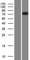 Western blot validation of overexpression lysate (Cat# LY420534) using anti-DDK antibody (Cat# TA50011-100). Left: Cell lysates from un-transfected HEK293T cells; Right: Cell lysates from HEK293T cells transfected with RC216663 using transfection reagent MegaTran 2.0 (Cat# TT210002).