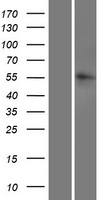 Western blot validation of overexpression lysate (Cat# LY420698) using anti-DDK antibody (Cat# TA50011-100). Left: Cell lysates from un-transfected HEK293T cells; Right: Cell lysates from HEK293T cells transfected with RC216649 using transfection reagent MegaTran 2.0 (Cat# TT210002).