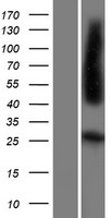 Western blot validation of overexpression lysate (Cat# LY421041) using anti-DDK antibody (Cat# TA50011-100). Left: Cell lysates from un-transfected HEK293T cells; Right: Cell lysates from HEK293T cells transfected with RC216623 using transfection reagent MegaTran 2.0 (Cat# TT210002).