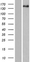 Western blot validation of overexpression lysate (Cat# LY412266) using anti-DDK antibody (Cat# TA50011-100). Left: Cell lysates from un-transfected HEK293T cells; Right: Cell lysates from HEK293T cells transfected with RC216422 using transfection reagent MegaTran 2.0 (Cat# TT210002).