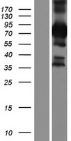 Western blot validation of overexpression lysate (Cat# LY404090) using anti-DDK antibody (Cat# TA50011-100). Left: Cell lysates from un-transfected HEK293T cells; Right: Cell lysates from HEK293T cells transfected with RC216190 using transfection reagent MegaTran 2.0 (Cat# TT210002).