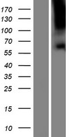 Western blot validation of overexpression lysate (Cat# LY410270) using anti-DDK antibody (Cat# TA50011-100). Left: Cell lysates from un-transfected HEK293T cells; Right: Cell lysates from HEK293T cells transfected with RC216396 using transfection reagent MegaTran 2.0 (Cat# TT210002).
