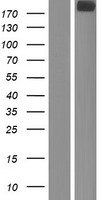 Western blot validation of overexpression lysate (Cat# LY414643) using anti-DDK antibody (Cat# TA50011-100). Left: Cell lysates from un-transfected HEK293T cells; Right: Cell lysates from HEK293T cells transfected with RC217071 using transfection reagent MegaTran 2.0 (Cat# TT210002).