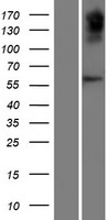 Western blot validation of overexpression lysate (Cat# LY404967) using anti-DDK antibody (Cat# TA50011-100). Left: Cell lysates from un-transfected HEK293T cells; Right: Cell lysates from HEK293T cells transfected with RC216870 using transfection reagent MegaTran 2.0 (Cat# TT210002).