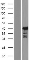 Western blot validation of overexpression lysate (Cat# LY416611) using anti-DDK antibody (Cat# TA50011-100). Left: Cell lysates from un-transfected HEK293T cells; Right: Cell lysates from HEK293T cells transfected with RC217304 using transfection reagent MegaTran 2.0 (Cat# TT210002).