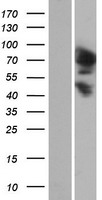 Western blot validation of overexpression lysate (Cat# LY422925) using anti-DDK antibody (Cat# TA50011-100). Left: Cell lysates from un-transfected HEK293T cells; Right: Cell lysates from HEK293T cells transfected with RC219776 using transfection reagent MegaTran 2.0 (Cat# TT210002).