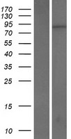 Western blot validation of overexpression lysate (Cat# LY411482) using anti-DDK antibody (Cat# TA50011-100). Left: Cell lysates from un-transfected HEK293T cells; Right: Cell lysates from HEK293T cells transfected with RC219772 using transfection reagent MegaTran 2.0 (Cat# TT210002).