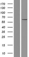 Western blot validation of overexpression lysate (Cat# LY414536) using anti-DDK antibody (Cat# TA50011-100). Left: Cell lysates from un-transfected HEK293T cells; Right: Cell lysates from HEK293T cells transfected with RC219771 using transfection reagent MegaTran 2.0 (Cat# TT210002).