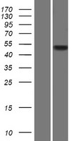 Western blot validation of overexpression lysate (Cat# LY421299) using anti-DDK antibody (Cat# TA50011-100). Left: Cell lysates from un-transfected HEK293T cells; Right: Cell lysates from HEK293T cells transfected with RC219717 using transfection reagent MegaTran 2.0 (Cat# TT210002).