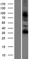 Western blot validation of overexpression lysate (Cat# LY414819) using anti-DDK antibody (Cat# TA50011-100). Left: Cell lysates from un-transfected HEK293T cells; Right: Cell lysates from HEK293T cells transfected with RC219694 using transfection reagent MegaTran 2.0 (Cat# TT210002).