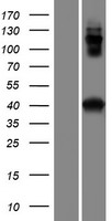 Western blot validation of overexpression lysate (Cat# LY421058) using anti-DDK antibody (Cat# TA50011-100). Left: Cell lysates from un-transfected HEK293T cells; Right: Cell lysates from HEK293T cells transfected with RC219680 using transfection reagent MegaTran 2.0 (Cat# TT210002).