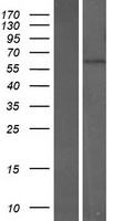 Western blot validation of overexpression lysate (Cat# LY408280) using anti-DDK antibody (Cat# TA50011-100). Left: Cell lysates from un-transfected HEK293T cells; Right: Cell lysates from HEK293T cells transfected with RC219766 using transfection reagent MegaTran 2.0 (Cat# TT210002).