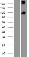 Western blot validation of overexpression lysate (Cat# LY412916) using anti-DDK antibody (Cat# TA50011-100). Left: Cell lysates from un-transfected HEK293T cells; Right: Cell lysates from HEK293T cells transfected with RC219904 using transfection reagent MegaTran 2.0 (Cat# TT210002).