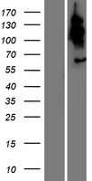 Western blot validation of overexpression lysate (Cat# LY421737) using anti-DDK antibody (Cat# TA50011-100). Left: Cell lysates from un-transfected HEK293T cells; Right: Cell lysates from HEK293T cells transfected with RC219900 using transfection reagent MegaTran 2.0 (Cat# TT210002).