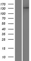 Western blot validation of overexpression lysate (Cat# LY408386) using anti-DDK antibody (Cat# TA50011-100). Left: Cell lysates from un-transfected HEK293T cells; Right: Cell lysates from HEK293T cells transfected with RC219891 using transfection reagent MegaTran 2.0 (Cat# TT210002).