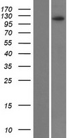 Western blot validation of overexpression lysate (Cat# LY409338) using anti-DDK antibody (Cat# TA50011-100). Left: Cell lysates from un-transfected HEK293T cells; Right: Cell lysates from HEK293T cells transfected with RC219859 using transfection reagent MegaTran 2.0 (Cat# TT210002).
