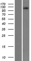 Western blot validation of overexpression lysate (Cat# LY409338) using anti-DDK antibody (Cat# TA50011-100). Left: Cell lysates from un-transfected HEK293T cells; Right: Cell lysates from HEK293T cells transfected with RC219859 using transfection reagent MegaTran 2.0 (Cat# TT210002).