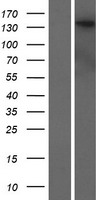 Western blot validation of overexpression lysate (Cat# LY408114) using anti-DDK antibody (Cat# TA50011-100). Left: Cell lysates from un-transfected HEK293T cells; Right: Cell lysates from HEK293T cells transfected with RC219440 using transfection reagent MegaTran 2.0 (Cat# TT210002).
