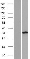 Western blot validation of overexpression lysate (Cat# LY423588) using anti-DDK antibody (Cat# TA50011-100). Left: Cell lysates from un-transfected HEK293T cells; Right: Cell lysates from HEK293T cells transfected with RC219570 using transfection reagent MegaTran 2.0 (Cat# TT210002).