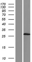 Western blot validation of overexpression lysate (Cat# LY422824) using anti-DDK antibody (Cat# TA50011-100). Left: Cell lysates from un-transfected HEK293T cells; Right: Cell lysates from HEK293T cells transfected with RC220247 using transfection reagent MegaTran 2.0 (Cat# TT210002).