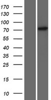 Western blot validation of overexpression lysate (Cat# LY421628) using anti-DDK antibody (Cat# TA50011-100). Left: Cell lysates from un-transfected HEK293T cells; Right: Cell lysates from HEK293T cells transfected with RC220192 using transfection reagent MegaTran 2.0 (Cat# TT210002).
