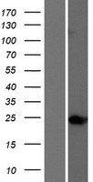 Western blot validation of overexpression lysate (Cat# LY414611) using anti-DDK antibody (Cat# TA50011-100). Left: Cell lysates from un-transfected HEK293T cells; Right: Cell lysates from HEK293T cells transfected with RC220249 using transfection reagent MegaTran 2.0 (Cat# TT210002).