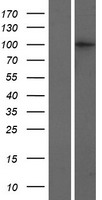 Western blot validation of overexpression lysate (Cat# LY413851) using anti-DDK antibody (Cat# TA50011-100). Left: Cell lysates from un-transfected HEK293T cells; Right: Cell lysates from HEK293T cells transfected with RC220334 using transfection reagent MegaTran 2.0 (Cat# TT210002).
