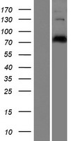 Western blot validation of overexpression lysate (Cat# LY410298) using anti-DDK antibody (Cat# TA50011-100). Left: Cell lysates from un-transfected HEK293T cells; Right: Cell lysates from HEK293T cells transfected with RC220007 using transfection reagent MegaTran 2.0 (Cat# TT210002).