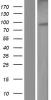 Western blot validation of overexpression lysate (Cat# LY423472) using anti-DDK antibody (Cat# TA50011-100). Left: Cell lysates from un-transfected HEK293T cells; Right: Cell lysates from HEK293T cells transfected with RC219951 using transfection reagent MegaTran 2.0 (Cat# TT210002).