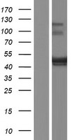 Western blot validation of overexpression lysate (Cat# LY413602) using anti-DDK antibody (Cat# TA50011-100). Left: Cell lysates from un-transfected HEK293T cells; Right: Cell lysates from HEK293T cells transfected with RC218642 using transfection reagent MegaTran 2.0 (Cat# TT210002).