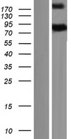 Western blot validation of overexpression lysate (Cat# LY404008) using anti-DDK antibody (Cat# TA50011-100). Left: Cell lysates from un-transfected HEK293T cells; Right: Cell lysates from HEK293T cells transfected with RC218756 using transfection reagent MegaTran 2.0 (Cat# TT210002).
