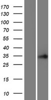 Western blot validation of overexpression lysate (Cat# LY422945) using anti-DDK antibody (Cat# TA50011-100). Left: Cell lysates from un-transfected HEK293T cells; Right: Cell lysates from HEK293T cells transfected with RC218379 using transfection reagent MegaTran 2.0 (Cat# TT210002).