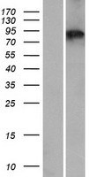 Western blot validation of overexpression lysate (Cat# LY411147) using anti-DDK antibody (Cat# TA50011-100). Left: Cell lysates from un-transfected HEK293T cells; Right: Cell lysates from HEK293T cells transfected with RC218415 using transfection reagent MegaTran 2.0 (Cat# TT210002).