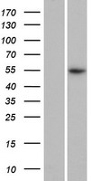 Western blot validation of overexpression lysate (Cat# LY420541) using anti-DDK antibody (Cat# TA50011-100). Left: Cell lysates from un-transfected HEK293T cells; Right: Cell lysates from HEK293T cells transfected with RC218336 using transfection reagent MegaTran 2.0 (Cat# TT210002).